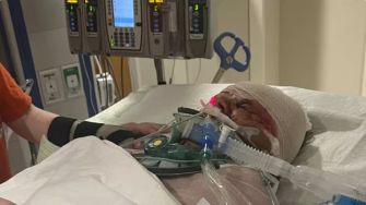 A hospitalized woman receiving medical treatment after suffering severe injuries from a dog attack.
